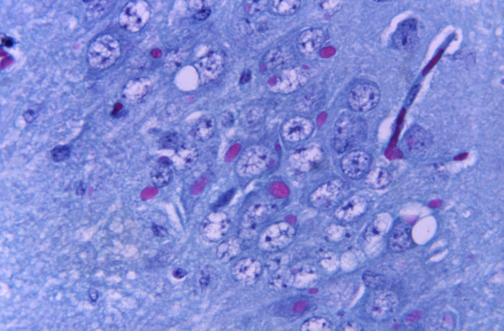 Two people treated after cat tests positive for rabies in Coventry Two people treated after cat tests positive for rabies in Coventry