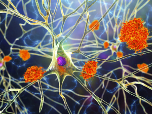 KY scientists learned what causes sleep loss in Alzheimer’s patients — and how to stop it 