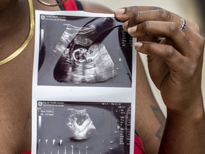 Maternity care deserts make up nearly half of Mississippi counties, March of Dimes says