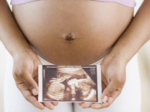 Arizona Republicans want schools to teach fetal development but not sex, STIs or abortion