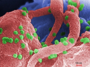 Chlamydia falls, new HIV cases rise in latest Rhode Island sexually transmitted infections data