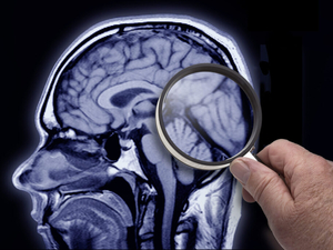 Idaho families are paying the price of late Alzheimer’s diagnoses, but ASAP Act could help