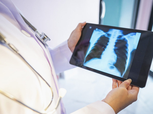 Ban on some insurance prior authorizations expected to cut red tape