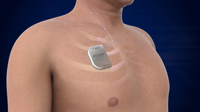 MUSC to study first-ever fully internal cochlear implants as part of national trial