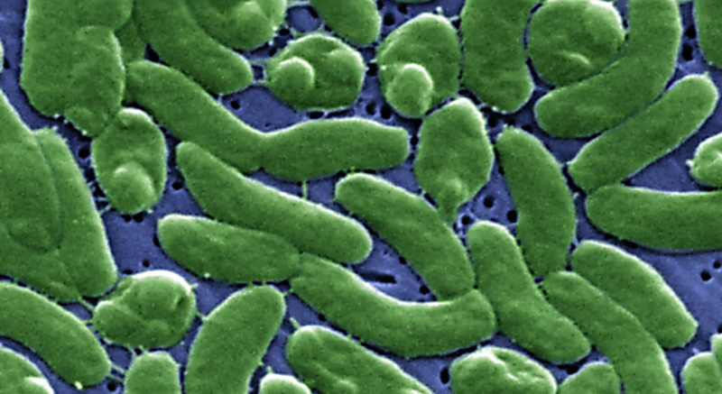 A grouping of Vibrio vulnificus bacteria as seen magnified through an electron microscope. Centers for Disease Control / Colorized by James Gathany / Smith Collection / Gado / Getty Images via Grist