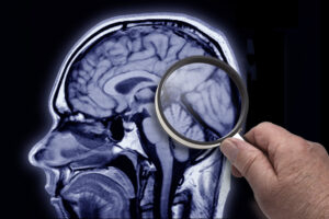 What USC’s planned $350M neurological hospital could mean for SC