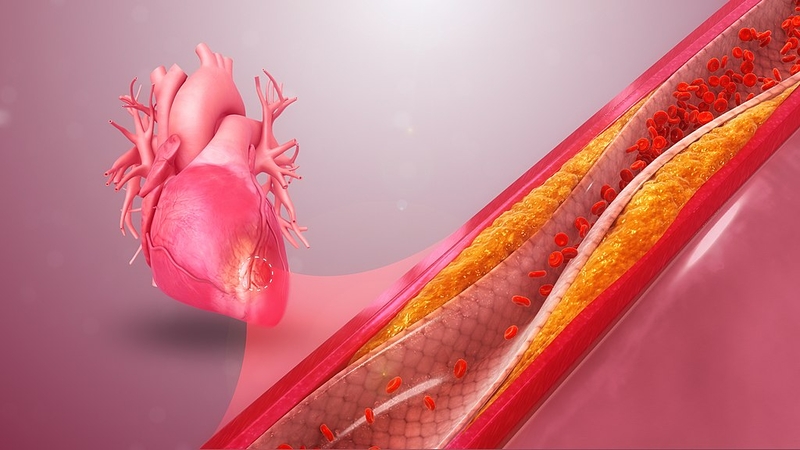 Cardiovascular disease is primed to kill older adults, especially people of color