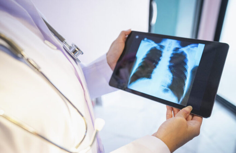 Taxpayers spend 22 percent more per patient to support Medicare Advantage