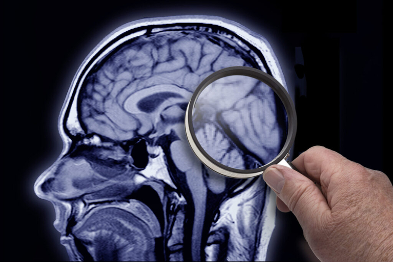 New Rutgers program aims to study the female brain