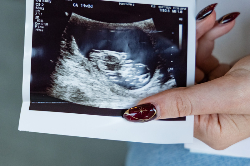 Told her baby wouldn’t survive, she had to leave Idaho for an abortion. She’s sharing her story.