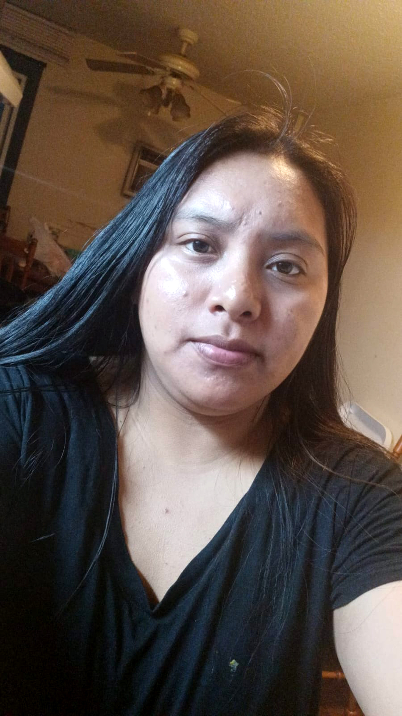 Doctors say woman in El Paso ICE detention center urgently requires surgery that she is being denied