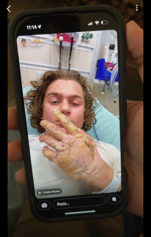 Raw eggs, ‘Scripture-backed fitness’ and a Porsche: The online world of the man accused of burning Mississippi’s largest synagogue