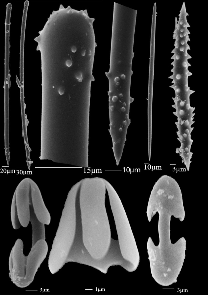 A microscopic image shows the structural elements of the newly discovered sponge species called Polycapus rubrum. The sponge represents a new-to-science sponge genus. (Photo provided by NOAA Fisheries)