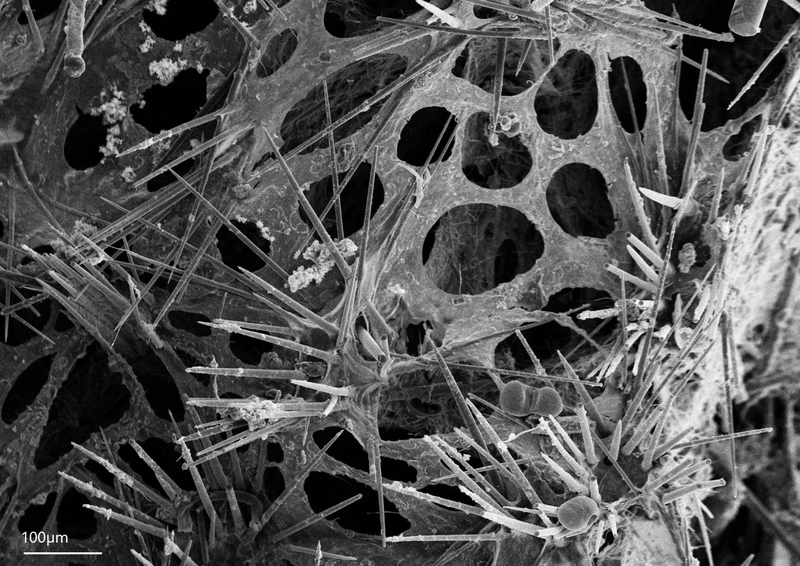 A microscopic image shows the structure of a newly discovered species now named Desmacella alaskensis. Scientists were able to identiry the new species by studying the spicules, the tiny structural elements within sponges. (Photo provided by NOAA Fisheries)