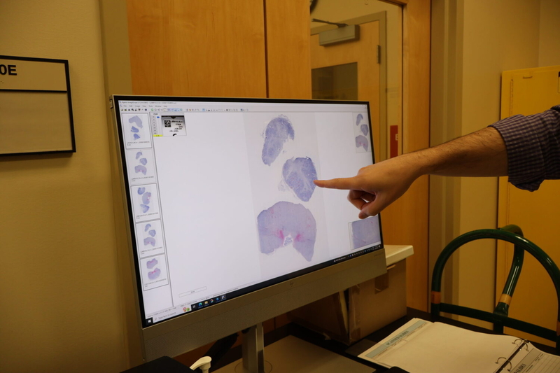 Pathologist Mariano Carossino points out areas in pinkish-red on a computer monitor in the Louisiana Animal Disease Diagnostic Laboratory. The spots confirm that the deer was infected with chronic wasting disease. (Elise Plunk/Louisiana Illuminator)